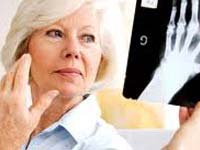 Arthritis Alternative