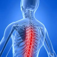 Arthritis Joint Pain
