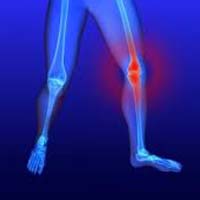 Glucosamine Chondrotin