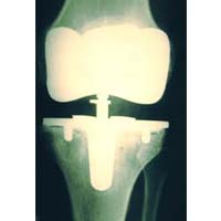 Glucosamine MSN