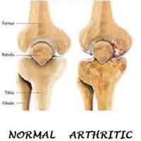 Glucosamine Products