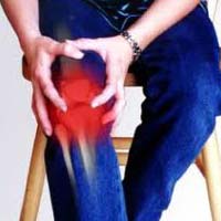 Joint Arthritis