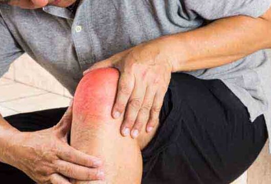 Knee Arthritis: What You Needed for Fighting Against Knee Arthritis