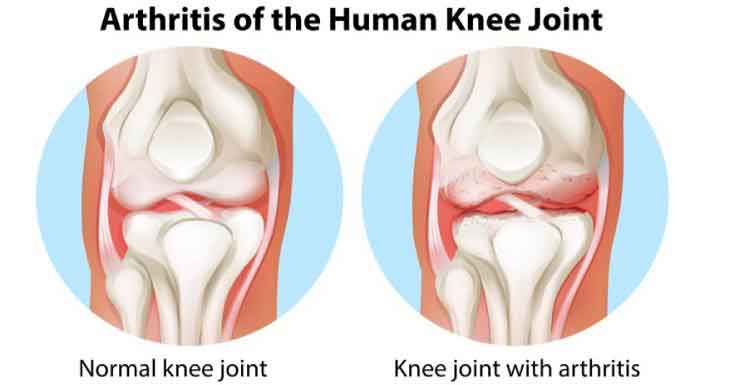 Knee Joint Detail