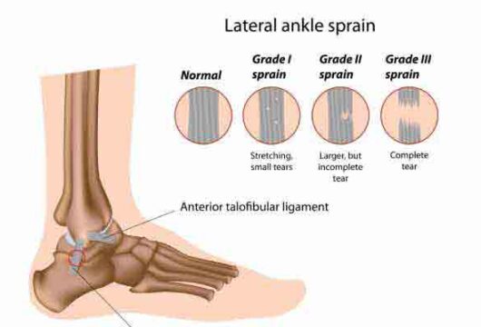 What are the Causes of Severe Ankle Joint Pain?