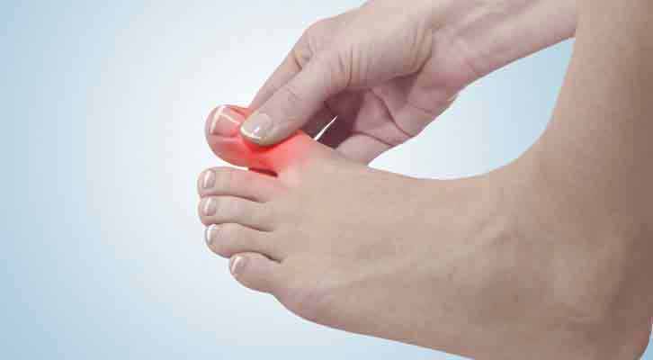 Parasites And Joint Pain Connection To Gout