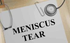 All You Should Know About A Meniscus Injury