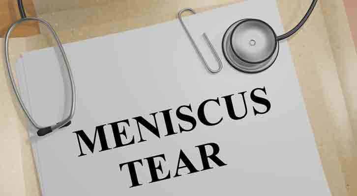 All You Should Know About A Meniscus Injury