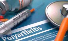 Polyarthritis: Symptoms, Causes, and Diagnosis