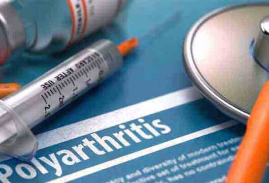 Polyarthritis: Symptoms, Causes, and Diagnosis