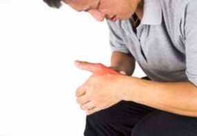 Basal Joint- Arthritis
