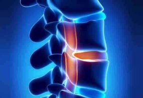 Facet Joint Pain