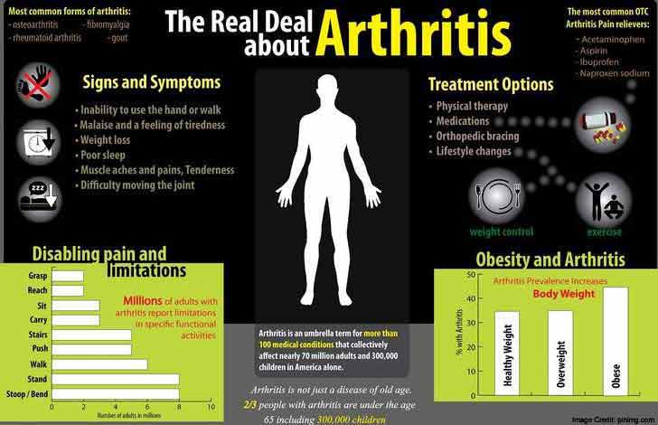 Deal Arthritis