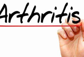Information about Arthritis