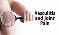 What are the Causes of Vasculitis?