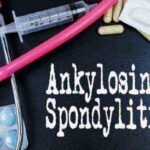 About Ankylosing Spondylitis