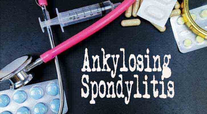 Ankylosing Spondylitis – What You Really Need To Know