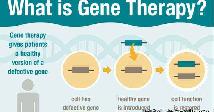 Gene Therapy