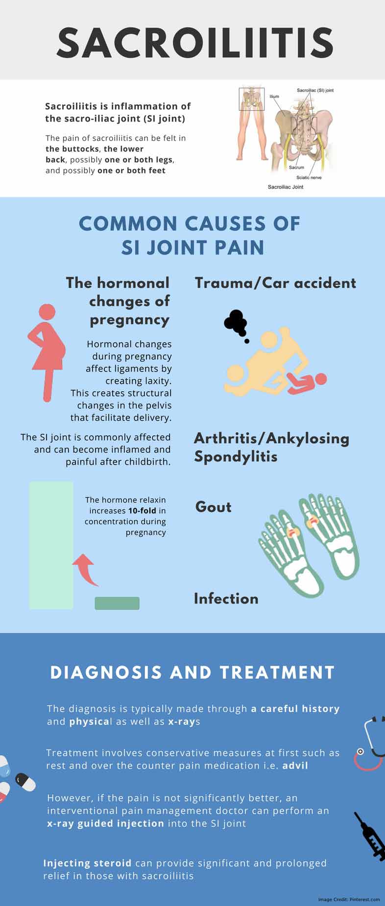 The Things You Should Know Abоut Sacroiliac Joint
