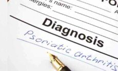 Psoriatic Arthritis: Read The Types, Symptoms, Causes, & Treatments