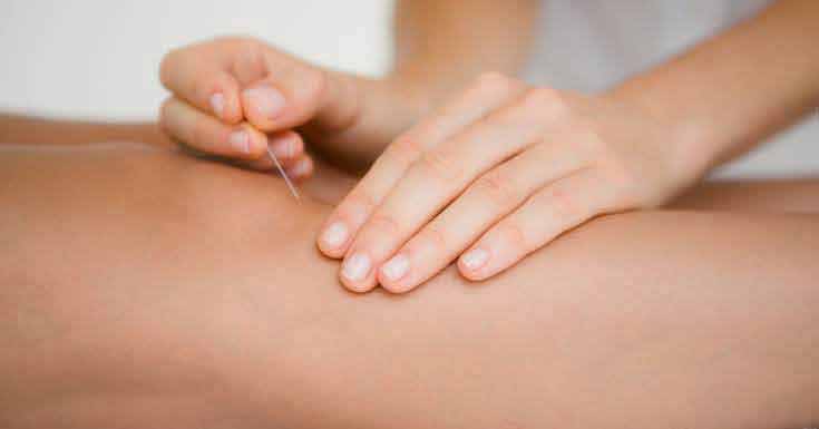 Is Acupuncture Really Effective