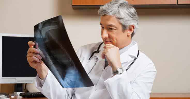 How to Diagnose Shoulder Bursitis