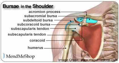 Symptoms of Shoulder Bursitis
