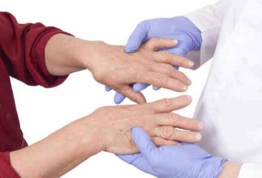 Relation Between Biologics & Cancer In Rheumatoid Arthritis Patients