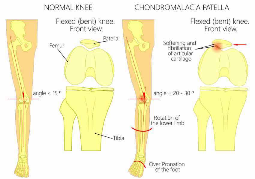 Normal Leg Healthy Knee