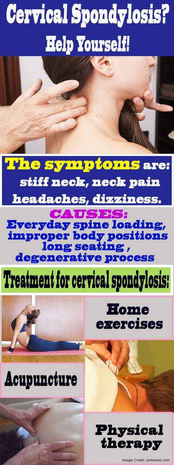Spondylitis Info