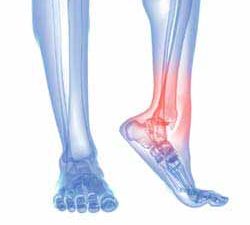 How Do You Treat Foot Pain?