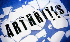 Arthritis Joint Pain: Symptoms, Causes, Types Risk, Prevention and Treatment