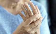 Rheumatoid Arthritis: Signs and Symptoms, Causes, Treatment
