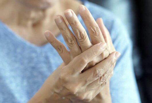 Rheumatoid Arthritis: Signs and Symptoms, Causes, Treatment